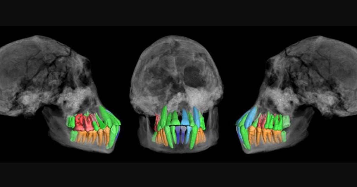 Skull and dentition of a young individual of early Homo from Dmanisi
